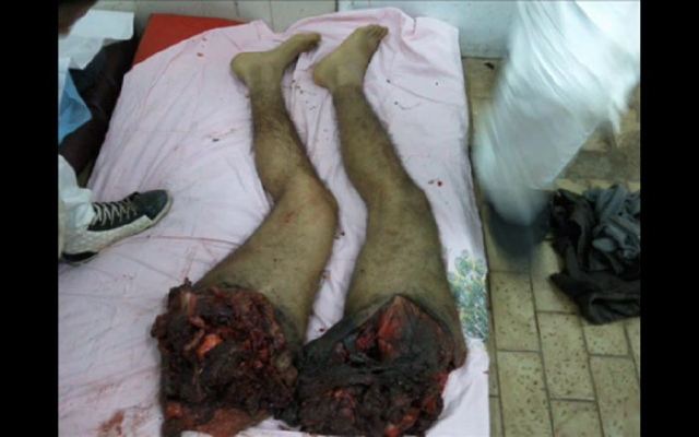 War crimes in Libya